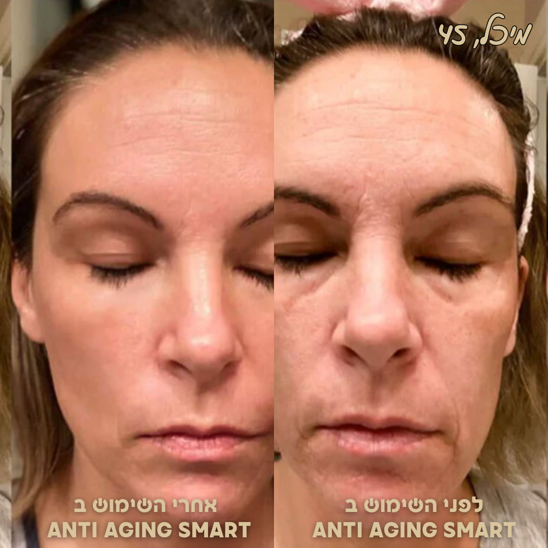 ANTI AGING SMART